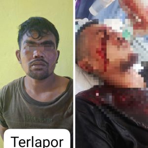 Dilaporkan Ke Istrinya, Pria di Batang Gansal Tebas Wajah Korban Menggunakan Parang